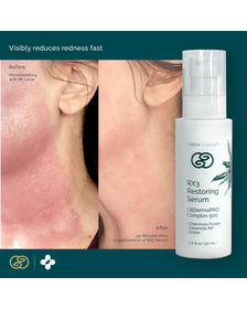 RX3 Restoring Serum - 1oz_CBDee